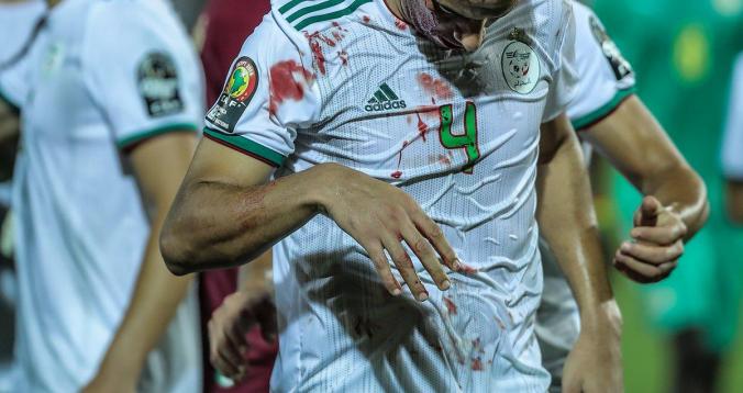 إصابة لاعب جزائري